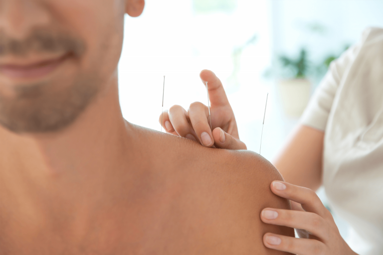 Acupuncture treatment